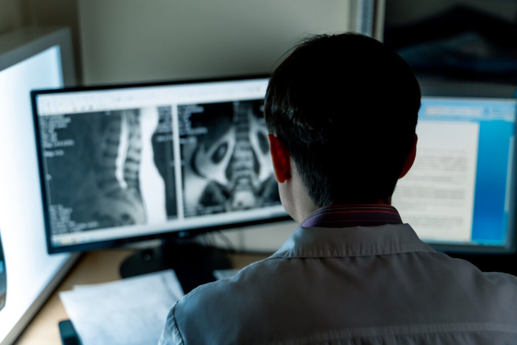  Medical professional seated with back to camera, reviewing X-ray images on two computer monitors.